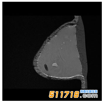 美國CIRS 073多模式乳房活檢和超聲波訓練模體3.png