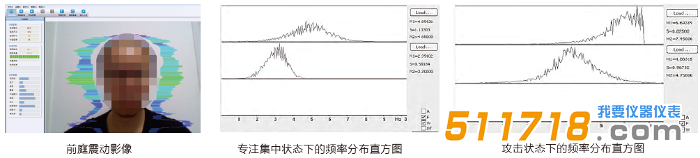 JT3010 心理健康狀態檢測.png